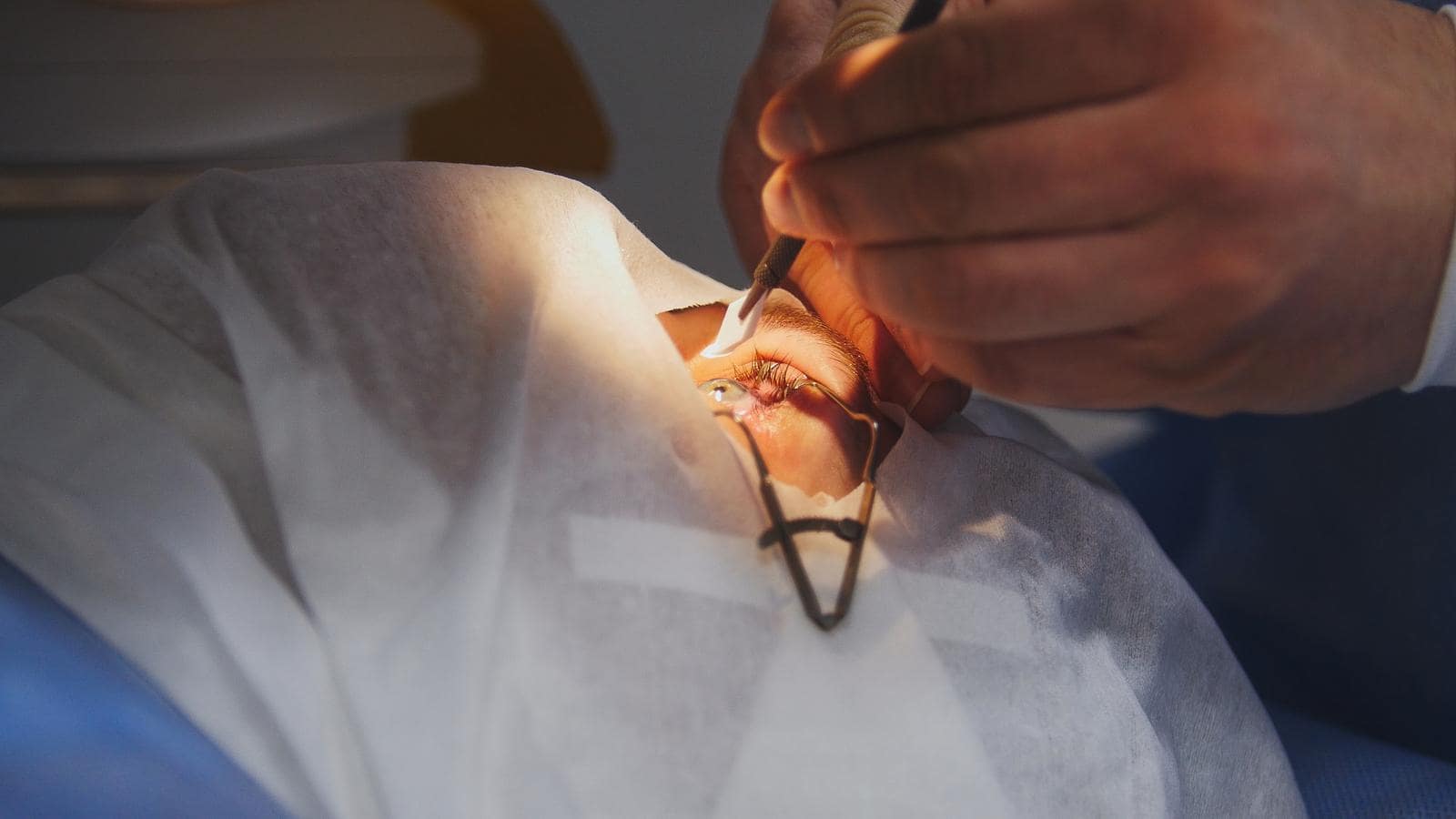 A surgeon performs an eye operation under bright light. The patient is covered with a sterile sheet, exposing only the eye. The surgeon's hands hold precision instruments near the patient's eye.