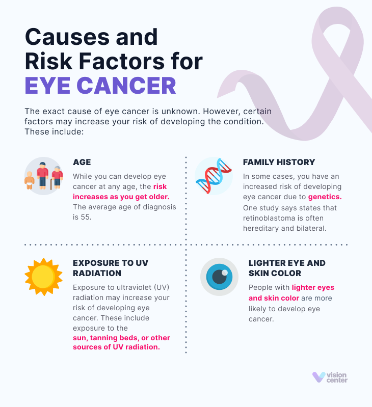 Causes and Risk Factors for Eye Cancer
