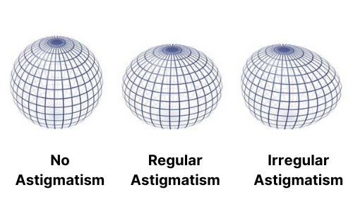 Astigmatism sphere diagram