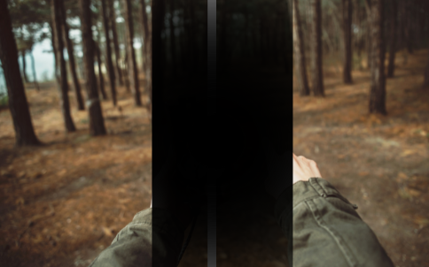 Bitemporal hemianopsia