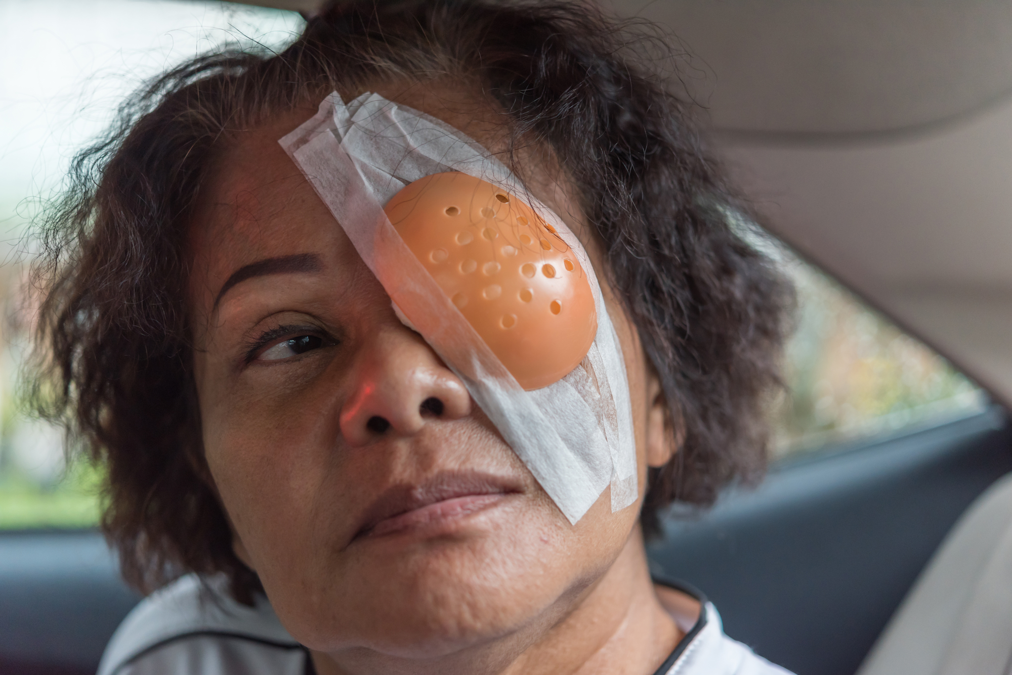 Patient Asian Women Show Her Eyes with Eye Shield after LASIK