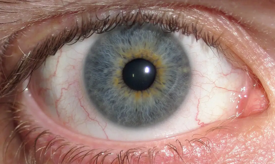 Close-up of a grey eye with an amber ring around the pupil