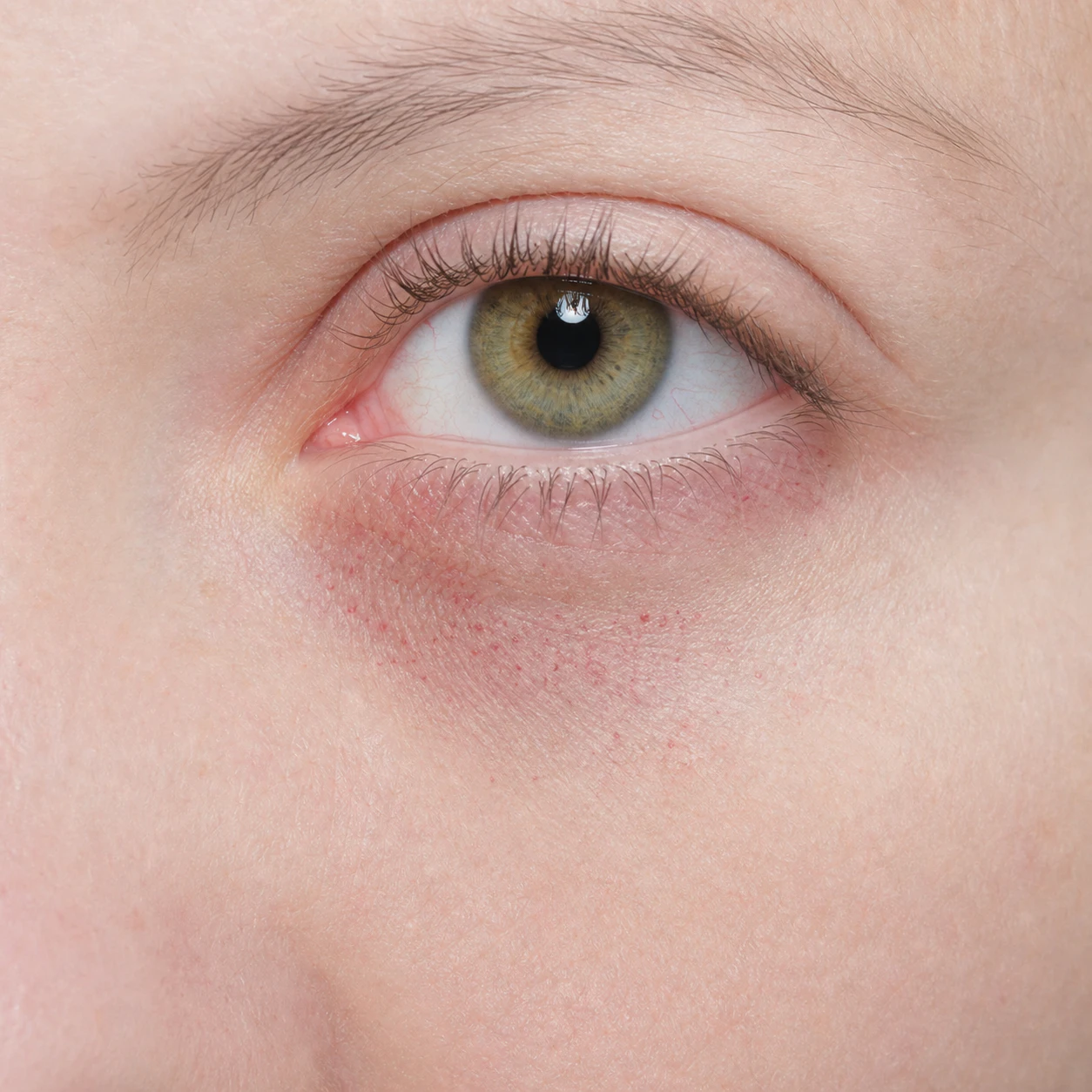 Petechiae photo 5