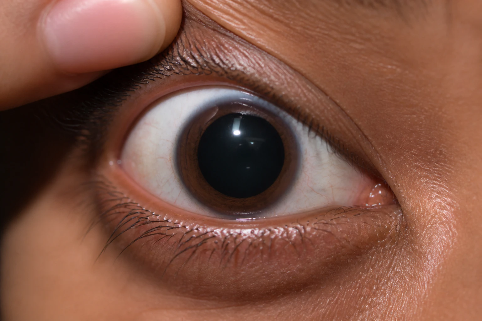 Close up of a dilated pupil during an eye examination