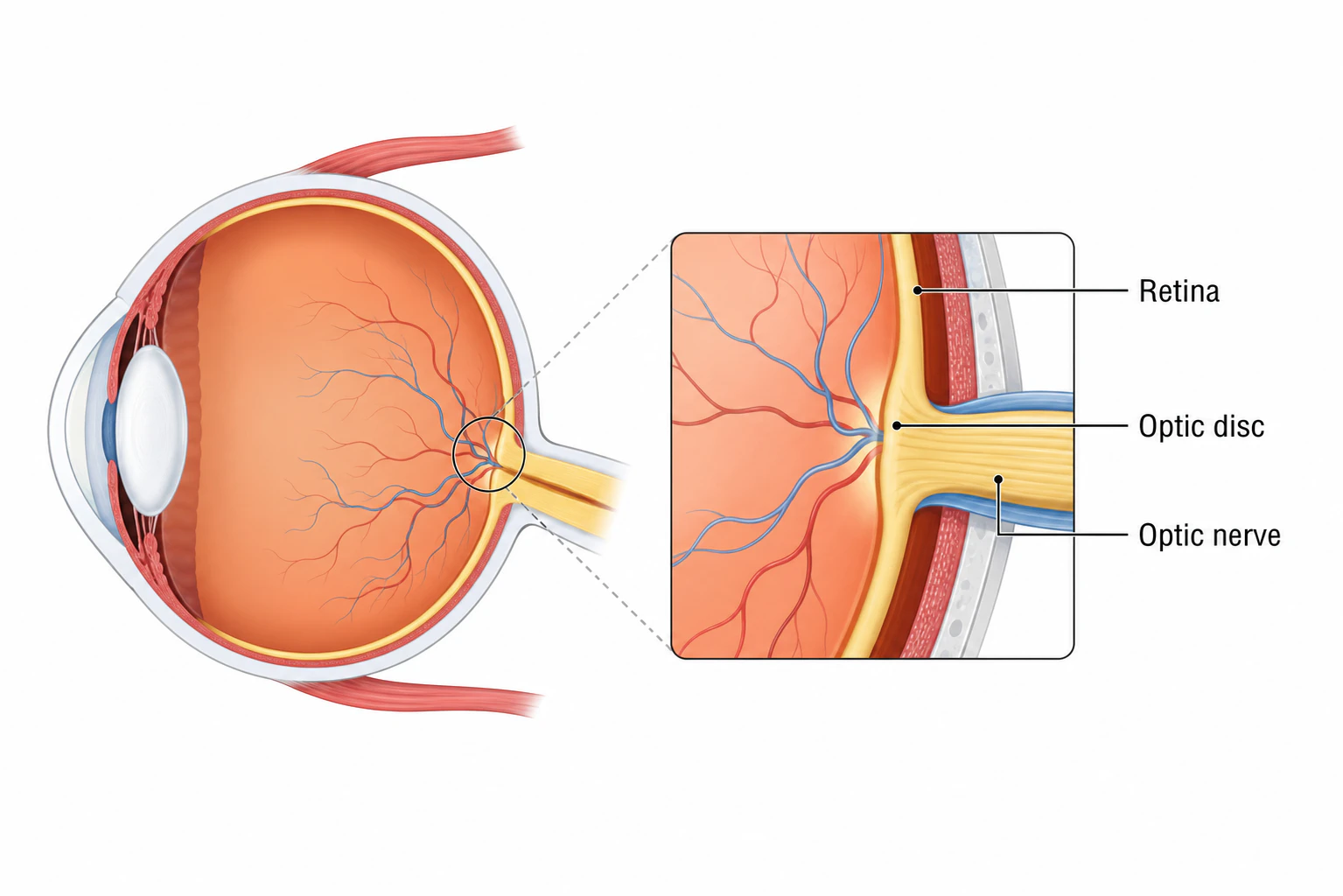 Illustration of the optic nerve visual pathway from the retina through the optic chiasm to the visual cortex.