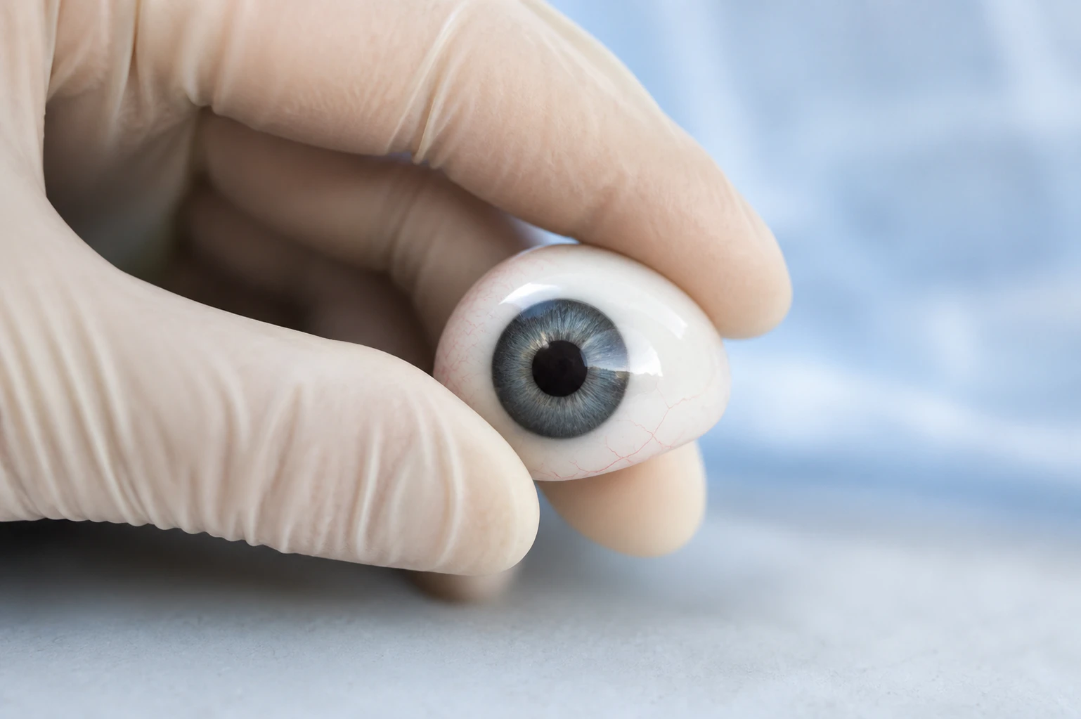 A custom-made acrylic prosthetic eye, also called an ocular prosthesis, held by a surgeon during a fitting