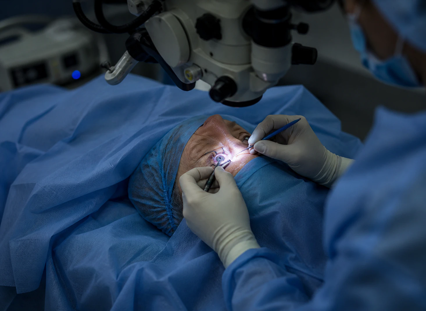 Close up shot of a patient undergoing a cataract operation