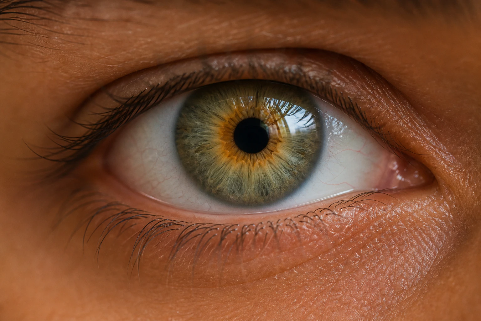 Hazel eye