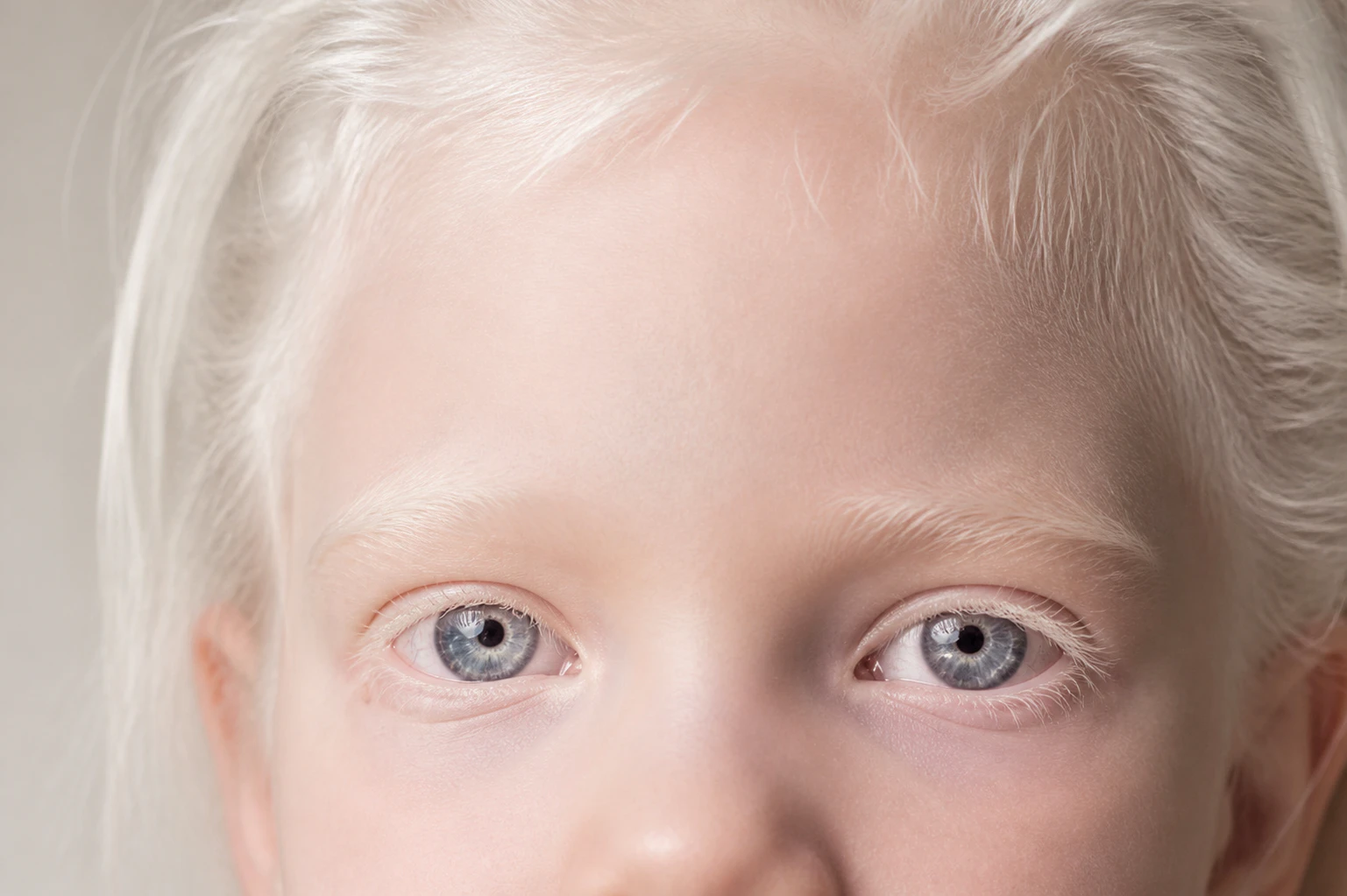 Close-up of blue eyes of an albino child