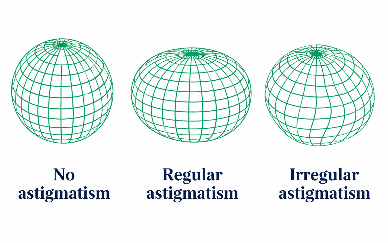 Astigmatism sphere diagram