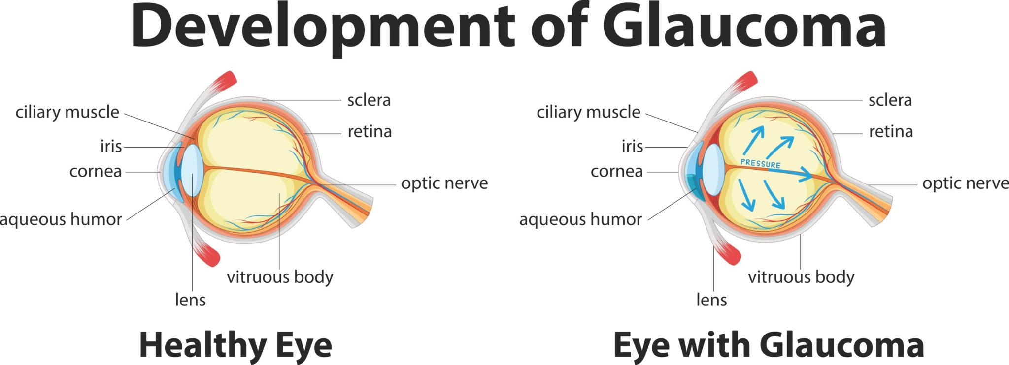 5 Types of Symptoms, Risk, and Treatment Options