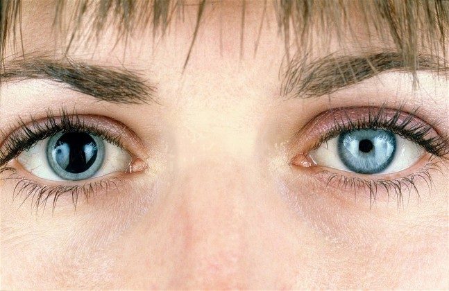 Anisocoria Unequal Pupil Sizes Causes Treatments