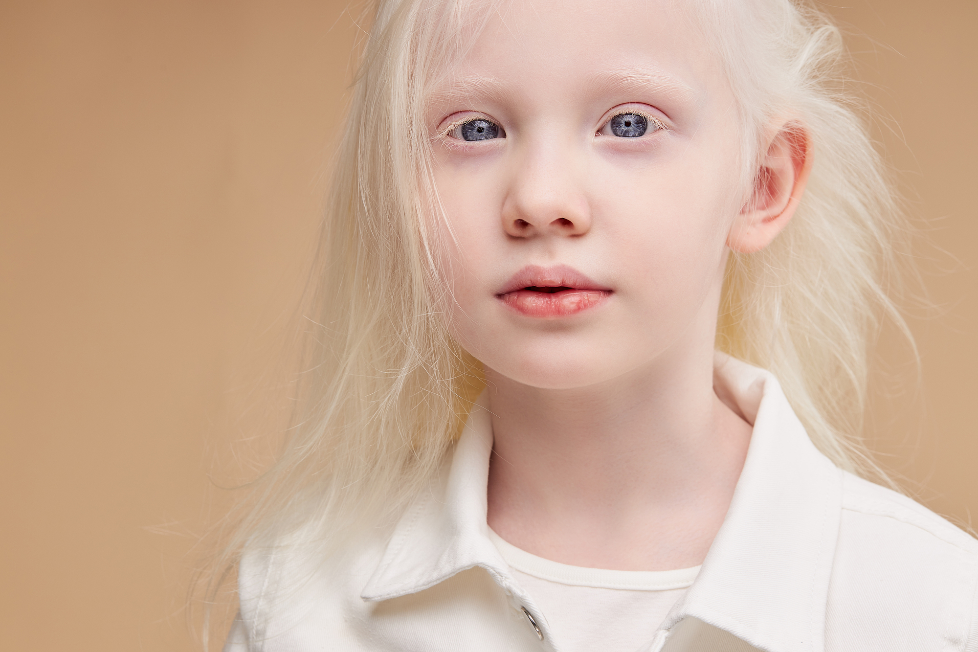Albino Eye Color Understanding Its Unique Appearance