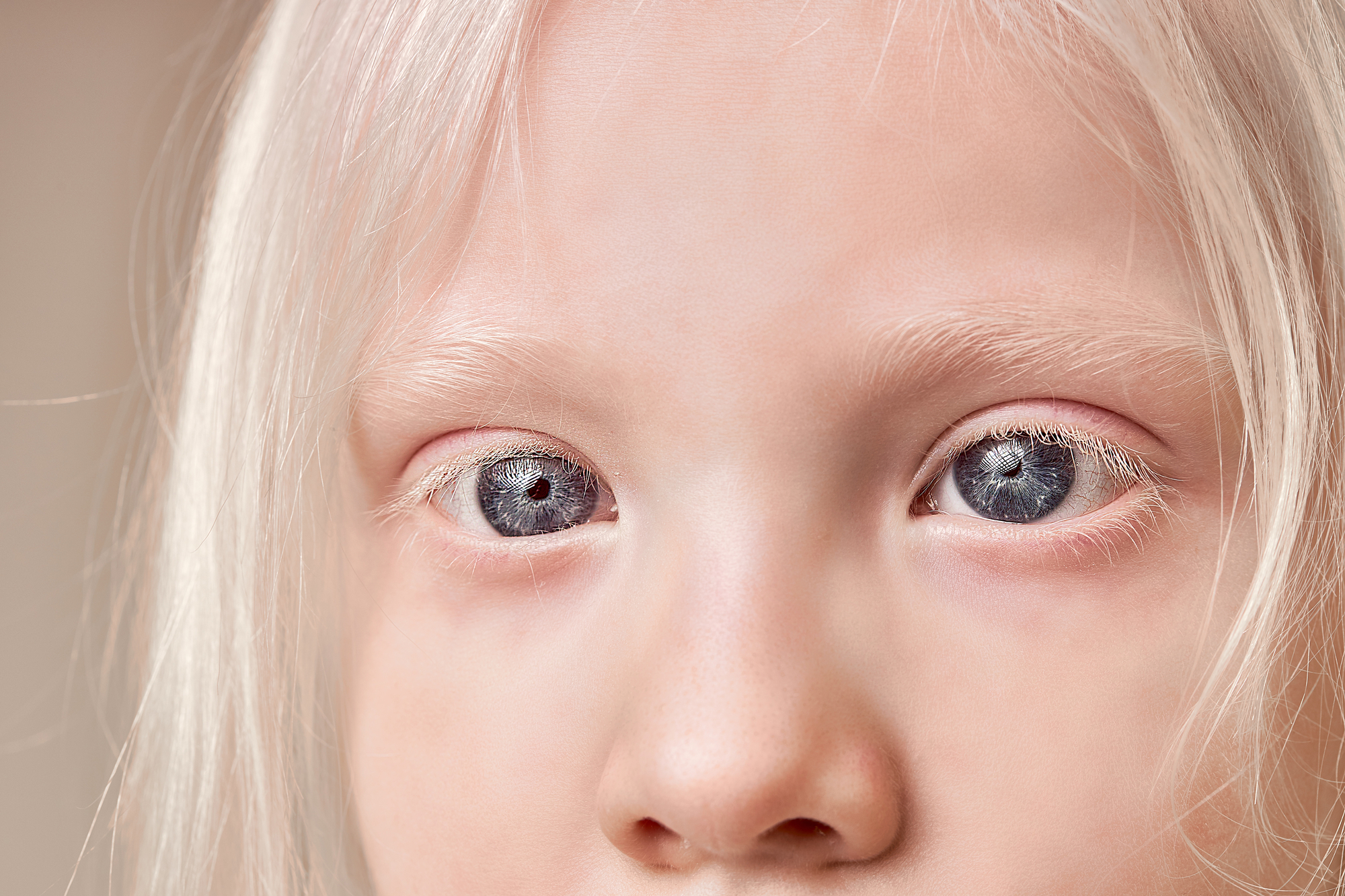 Close up photo of blue eyes of albino child girl
