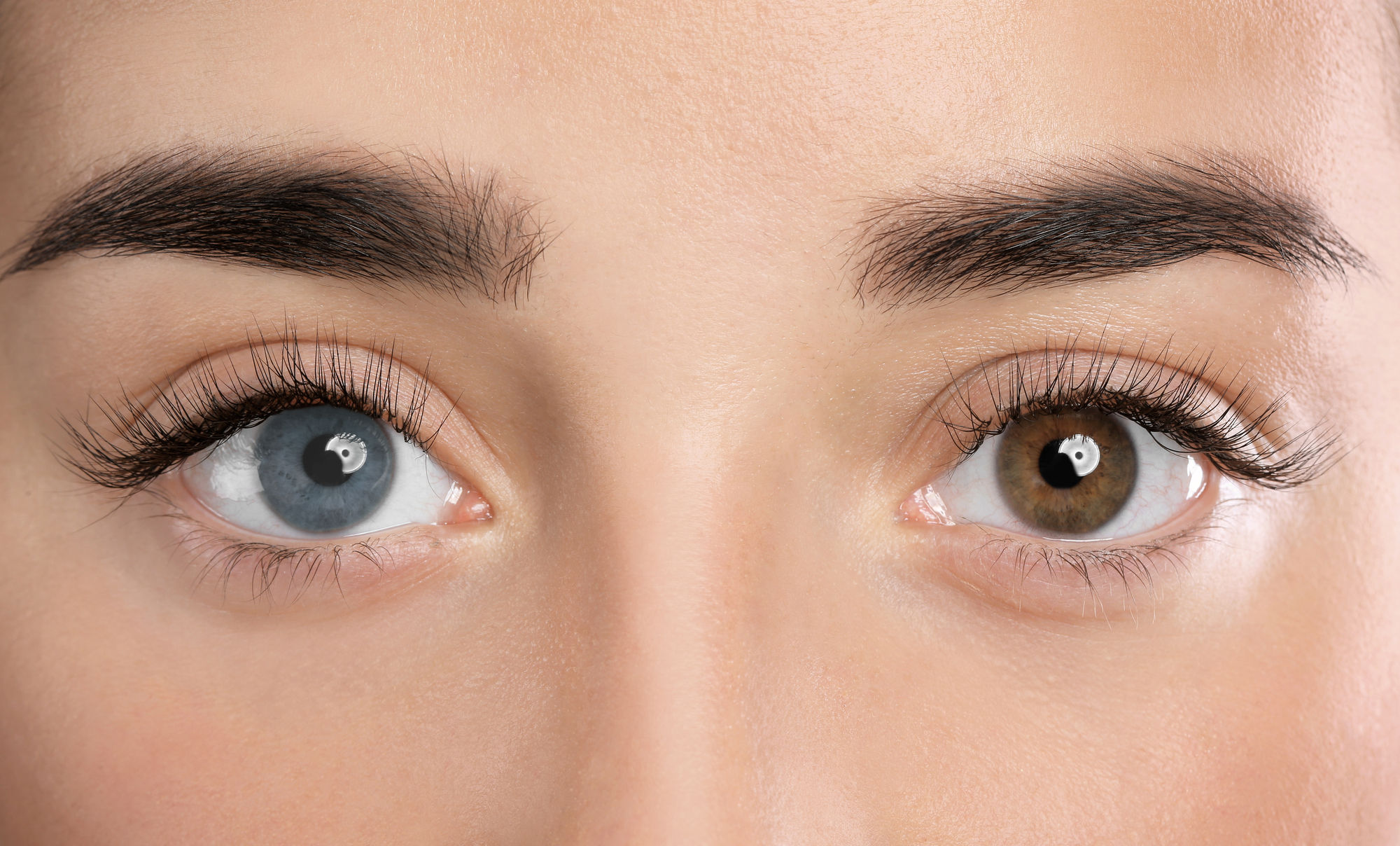 Complete heterochromia shown by the eyes of a young woman