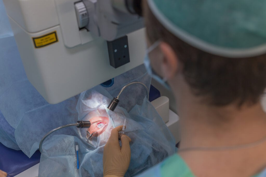 LASIK for Farsightedness - Procedure, Aftercare, Risks & Costs 4 LASIK ophtalmology operation for farsightedness
