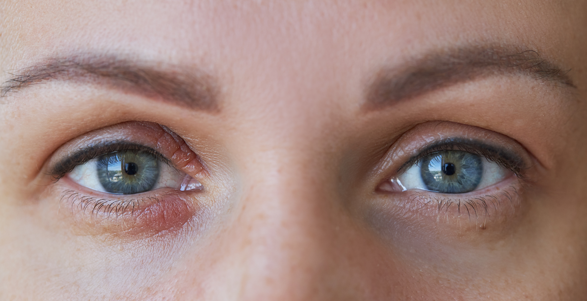 Close-up of a person's face showing blue eyes with visible details. Eyebrows are shaped, and there are natural skin textures around the eyes.