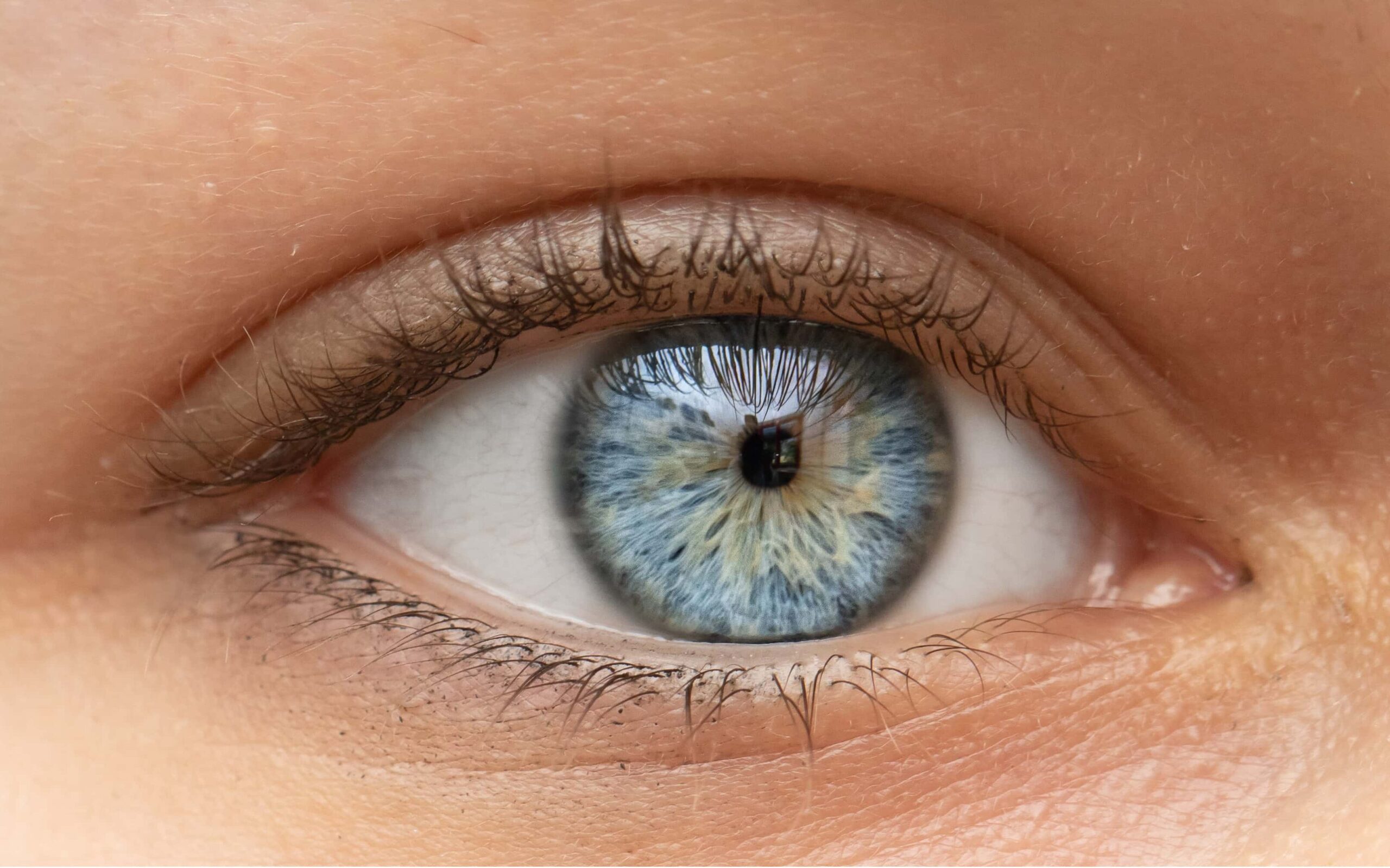 Miosis Causes & Treatments 3 close up shot of womna s eyes with miosis edited scaled