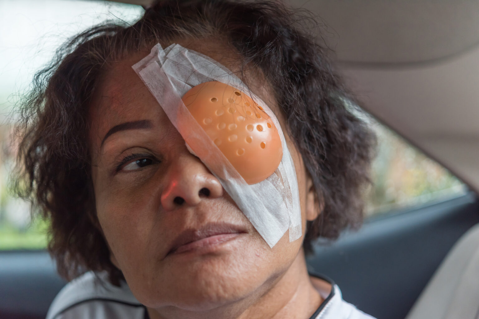 Eye Shields for Sleeping After LASIK Why, When, and How