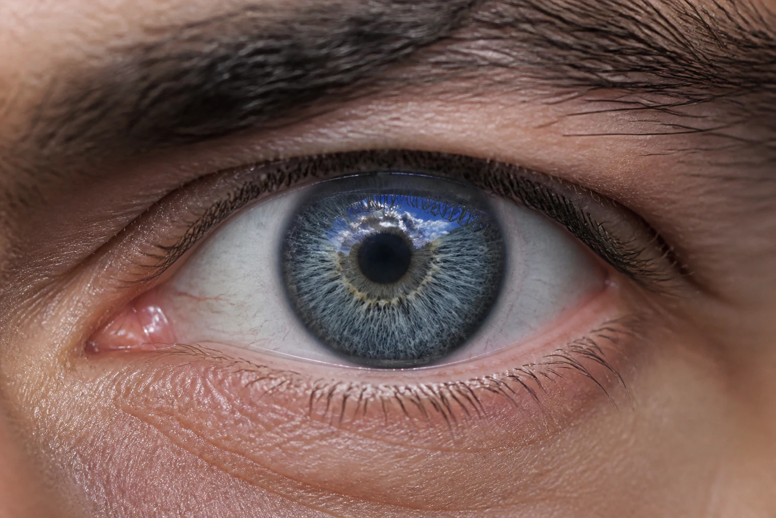 What Are Bitot’s Spots?